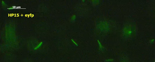 Marine bacteria tagged with fluorescence are investigated in the laboratory for chemotaxis using a microscope. (Source: Constructor University) 