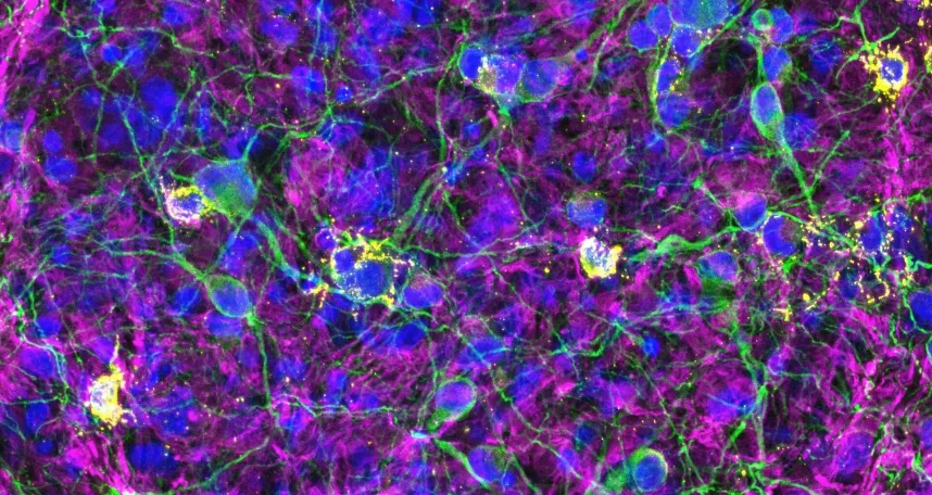 Cellular Neurobiology Group – Prof. Maren Schenke